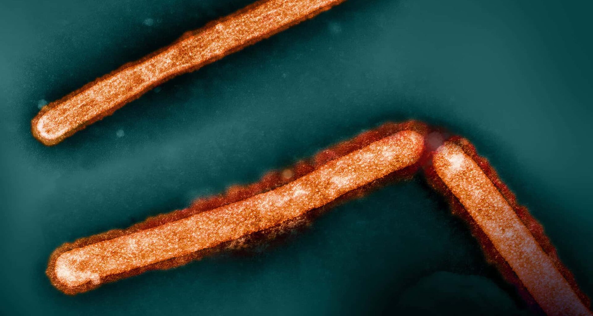 Italy Reports First Human Case of H9N2 Bird Flu