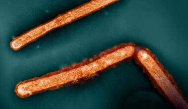 Italy Reports First Human Case of H9N2 Bird Flu