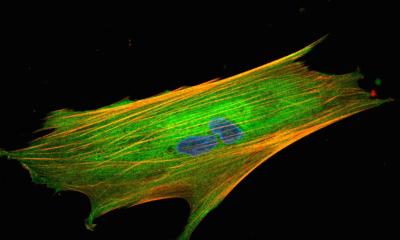 new biomarker shows which patients benefit from immunotherapy • healthcare-in-europe.com