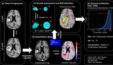 New biomarker helps assess glioblastoma aggressiveness • healthcare-in-europe.com