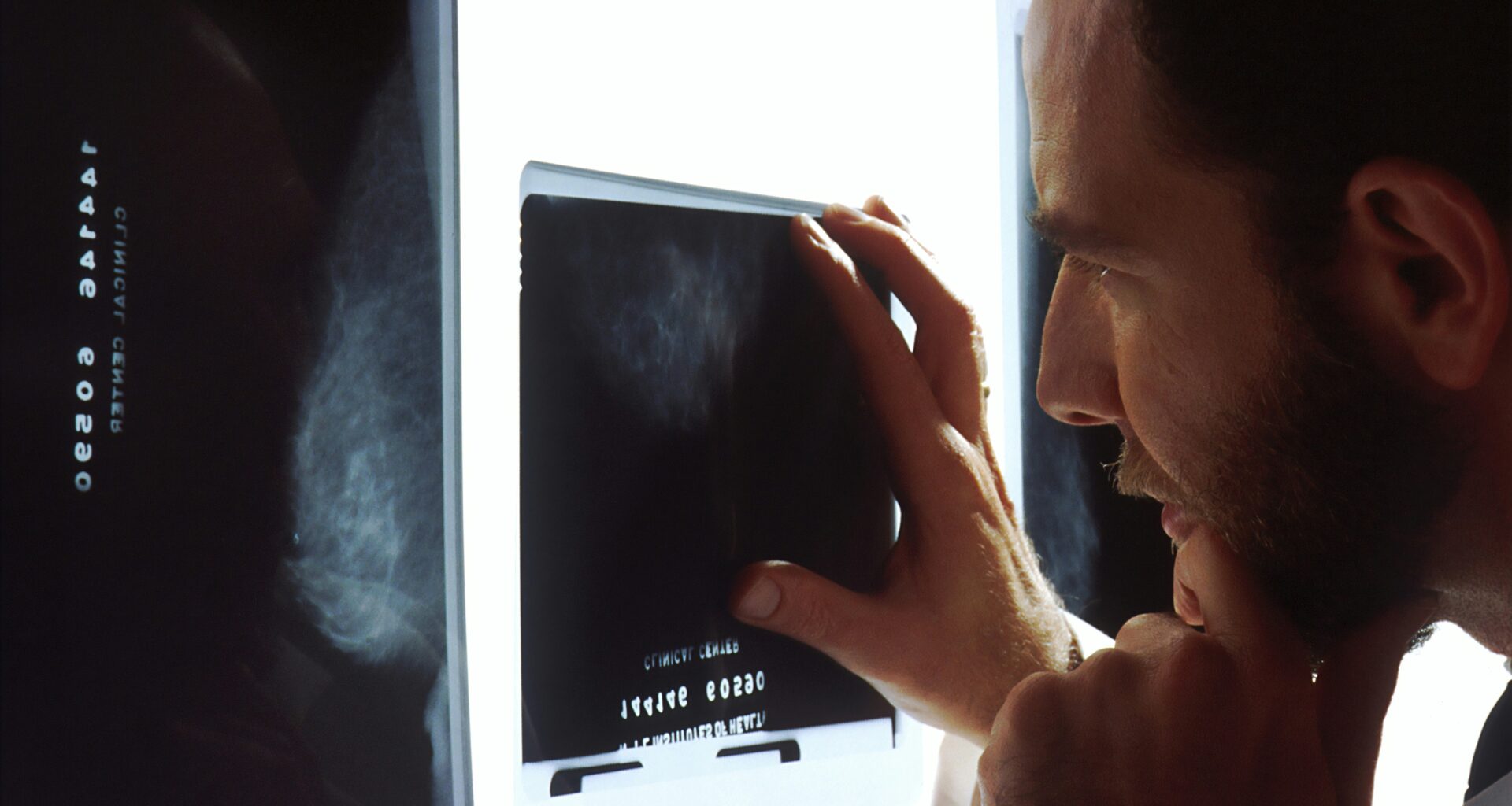 Blood Biomarker Found for Lynch Syndrome Cancer Risk