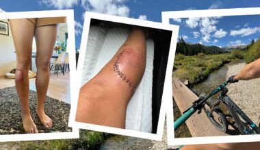 collage of bike injury and arterial gash