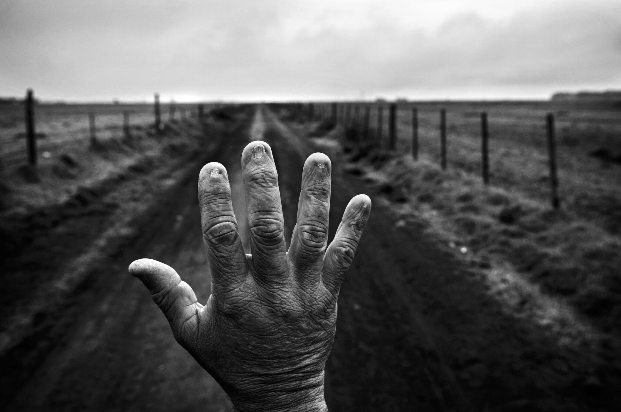 Pablo E. Piovano, “The Human Cost of Agrotoxins,” for the Manuel Rivera-Ortiz Foundation and Philip Jones Griffiths Foundation. Former land applicator Alfredo Cerán shows his burned fingernails. After years of mixing chemical products without adequate protection, he developed non-alcoholic cirrhosis and underwent a liver transplant. Cordoba, Argentina, September 23, 2015.