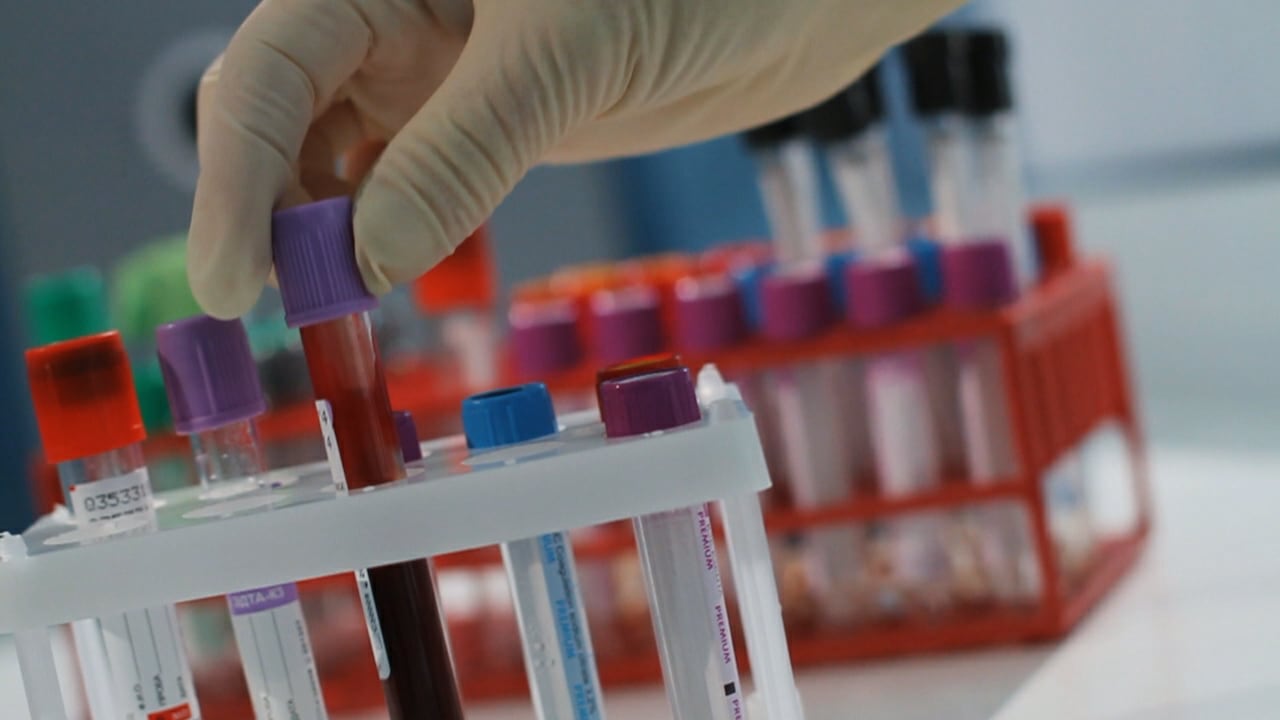 A gloved hand reaches for vials of blood. 