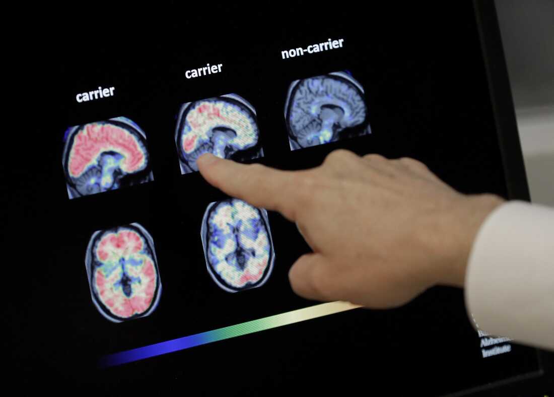 Indicator Dementia Risk