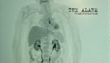 Album Review: The Alarm – Transformation  – The Indy Review