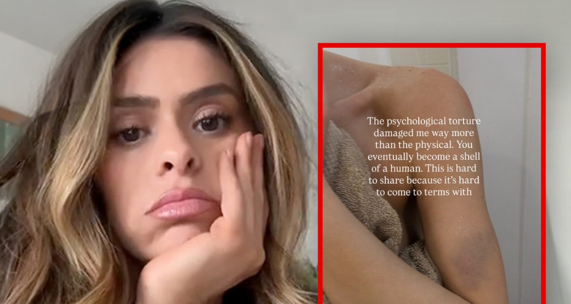 Taylor Frankie Paul Posts Bruised Arm, Opens Up About ‘Psychological Torture’