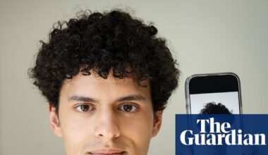 ‘You can’t control everything’: the rise in plastic surgeons asked to create ‘AI face’ | AI (artificial intelligence)
