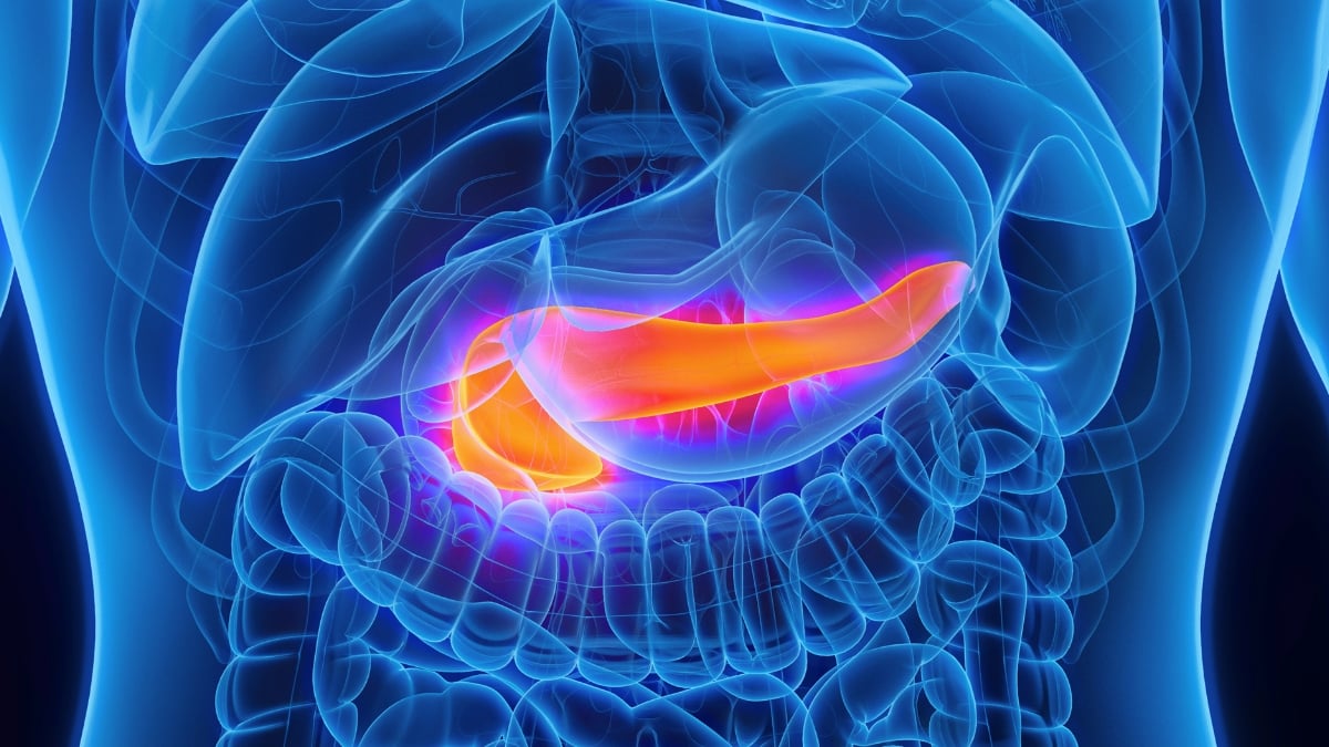 AI Can Spot Pancreatic Cancer Years Before Diagnosis, Study Finds : ScienceAlert