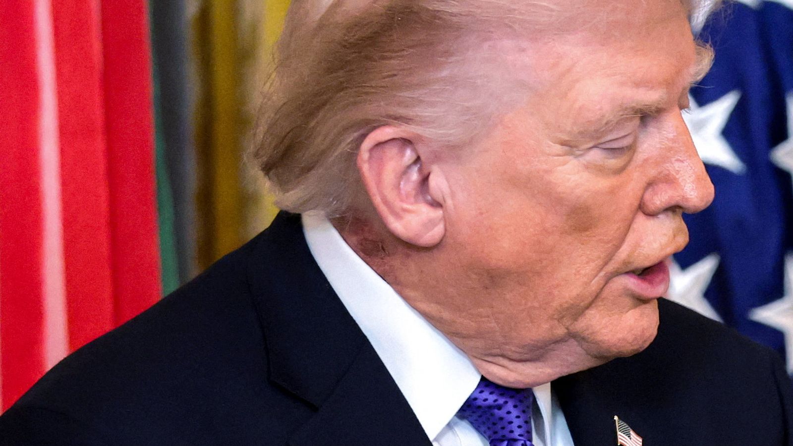 A patch of blemished skin is visible over Trump's shirt collar during a Medal of Honor ceremony Pic: Reuters