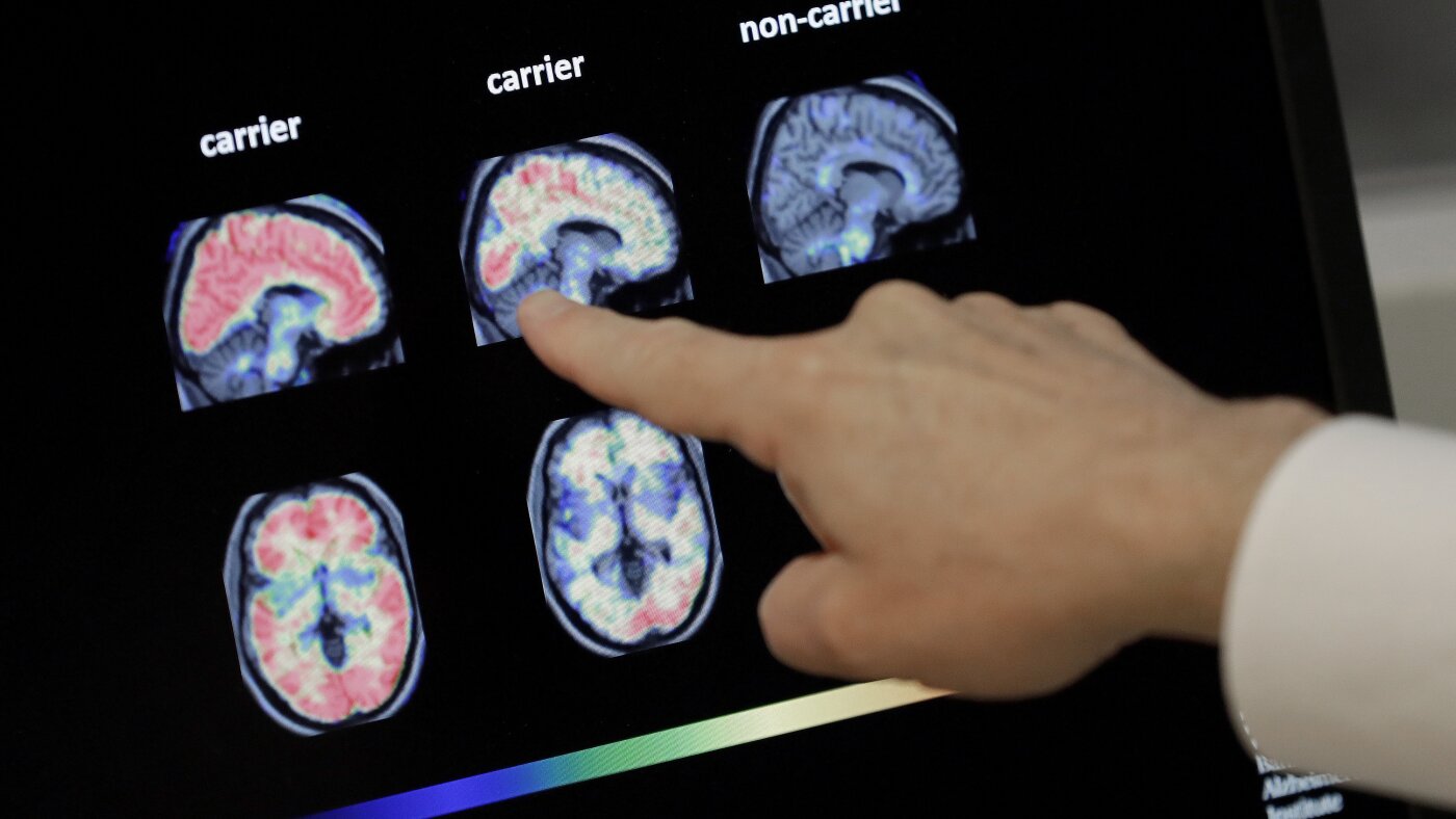 Can Chinese AI solve inequality? + How dementia comes for your bank account : NPR