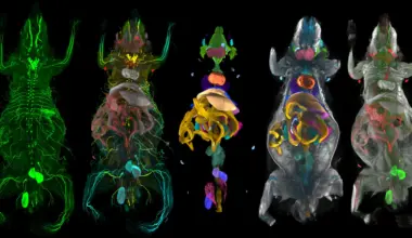 New AI body map reveals obesity’s hidden attack on facial nerves