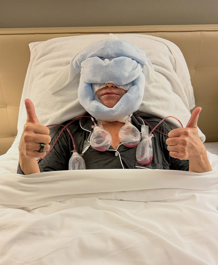 Patient recovering from plastic surgery with face wrapped in bandages giving thumbs up Patient recovering from plastic surgery with face wrapped in bandages giving thumbs up