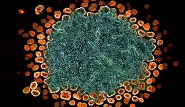 HIV, NIH, Ebola, gender care, puberty: Morning Rounds