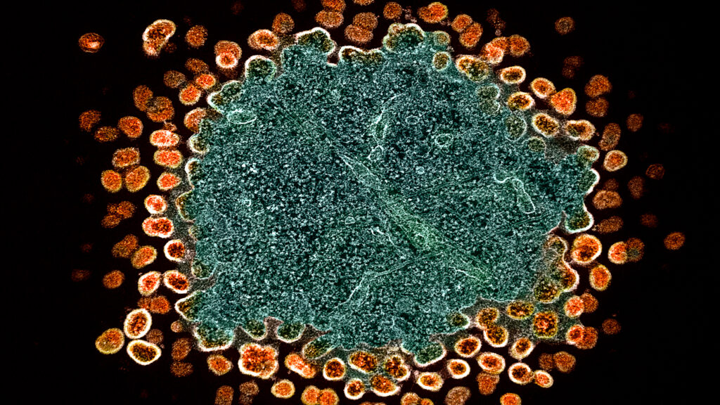 HIV, NIH, Ebola, gender care, puberty: Morning Rounds