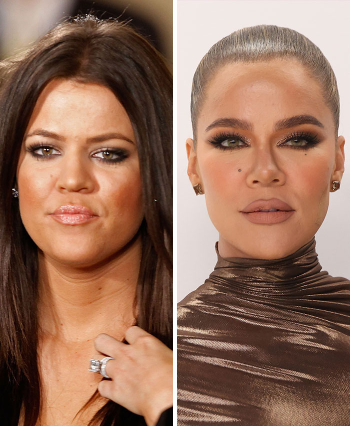 Side-by-side before and after images showing plastic surgery effects Side-by-side before and after images showing plastic surgery effects