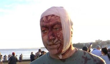 ‘Covered in ketchup’: Sydney terror attack survivor targeted by antisemitic deepfakes