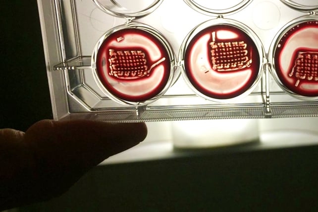 New Breakthrough to Strengthen Bone Could Reverse Osteoporosis