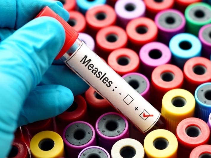 Connecticut Confirms First Measles Case Of 2026