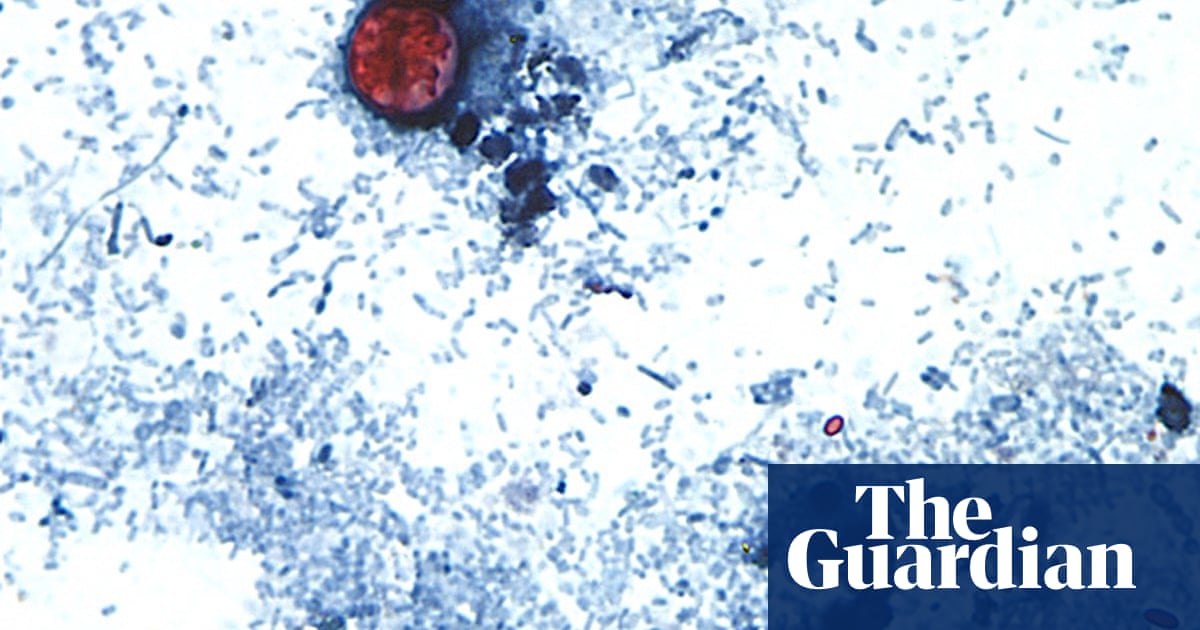 Is the cyclosporiasis outbreak slowing? Test-makers are hopeful | Infectious diseases