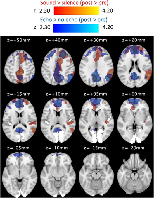 Brain charts