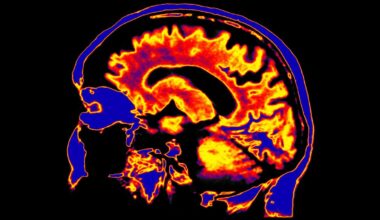 Scientists Discover a Potential Driver of Chronic Fatigue Syndrome Hiding Deep in The Brain : ScienceAlert