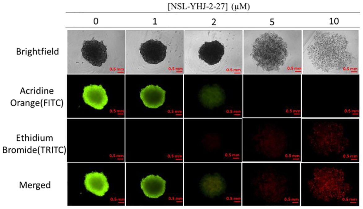 Experimental Compound Blocks 90% of Pancreatic Cancer Migration in The Lab