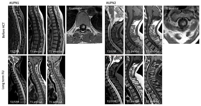 MRI scans