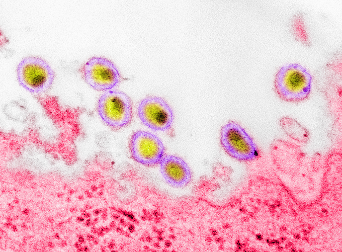 A New Kind of HIV Pill Just Passed Its First Test in Humans With HIV