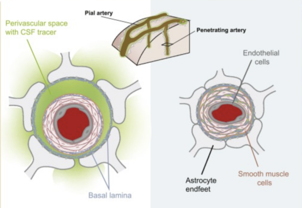 The Brain's Sewage System