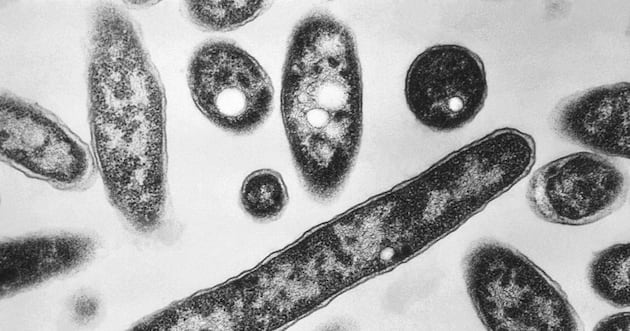 Legionnaires’ disease cluster in New York City takes third life – Deseret News