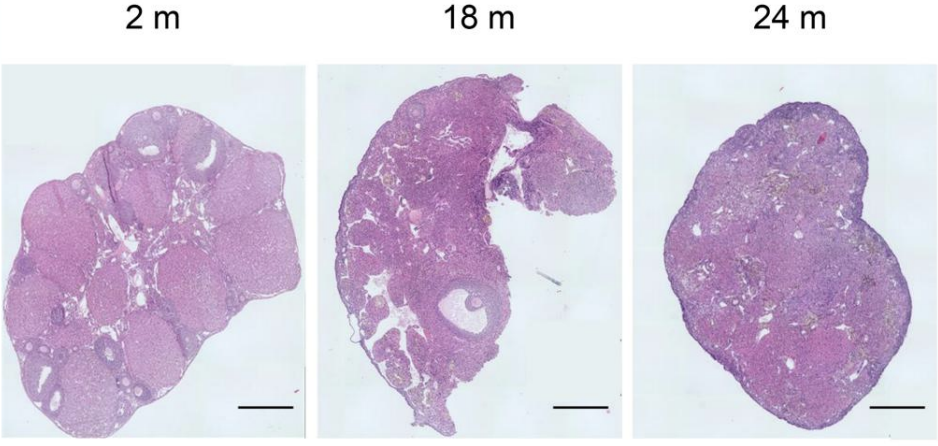 Ovaries Appear to Develop a Second Role After Menopause