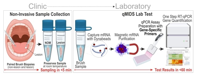 Painless Swab Detects Oral Cancers in an Hour, With Over 95% Accuracy