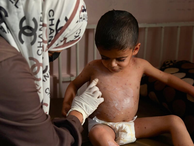 A woman wearing a medical glove points at the chest of a small boy wearing a diaper