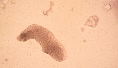 Israel’s Beresheet lander crashed into the Moon in 2019 carrying several thousand tardigrades in a dehydrated, dormant state—and although later experiments suggest they probably did not survive the impact, nobody knows whether any remain intact enough to be revived if they were ever recovered and rehydrated.