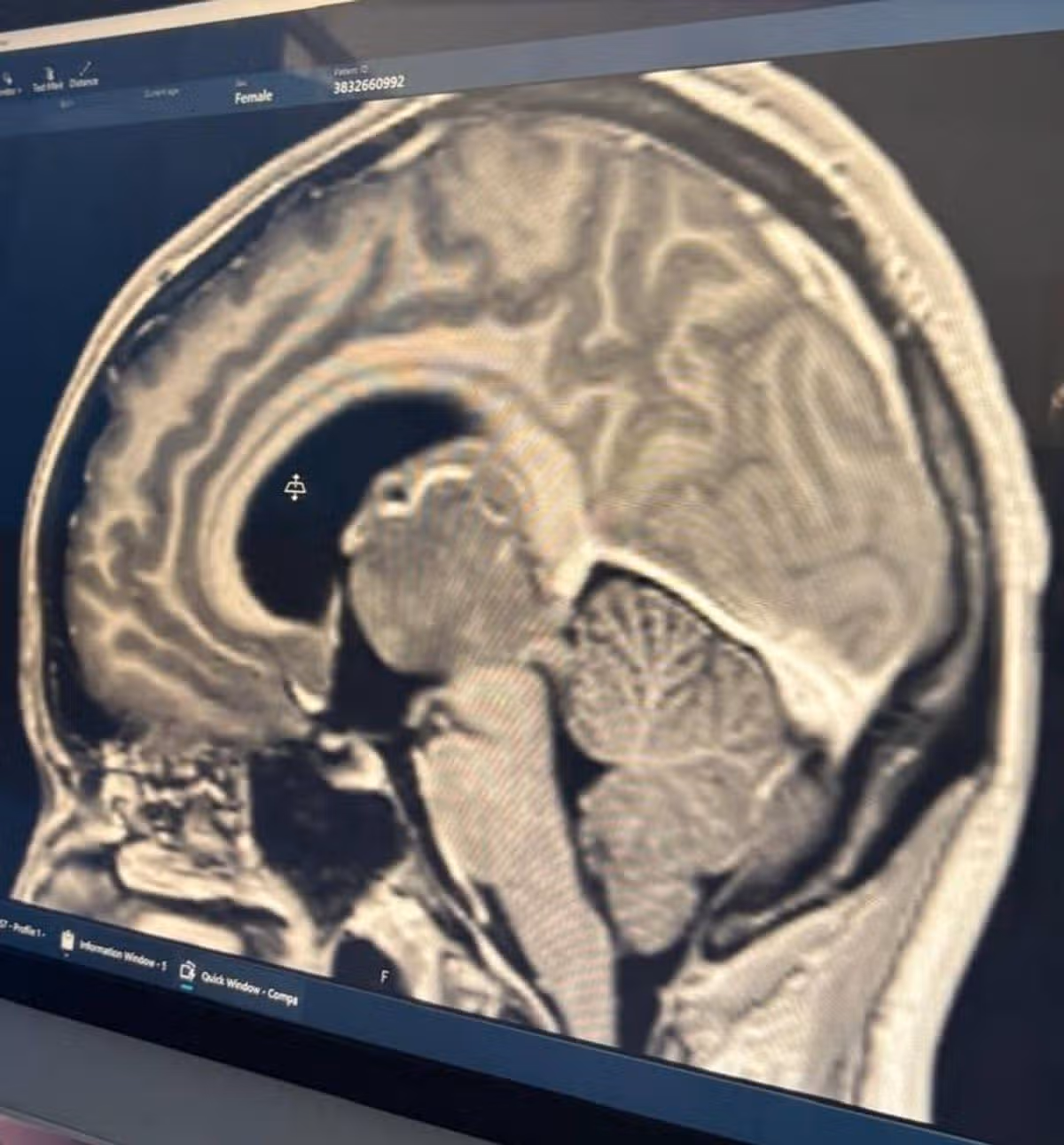 Caoimhe Jennings' head CT-scan result