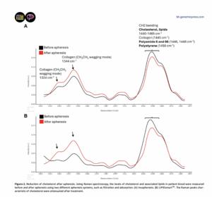 Cleaning cholesterol from blood also lowered forever chemicals and plastics, and nobody knows why