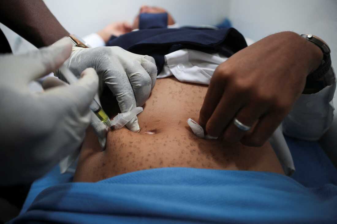 A health official gives a patient Lenacapavir, a long‑acting HIV prevention injection, in Epworth, outside the capital Harare, Zimbabwe.