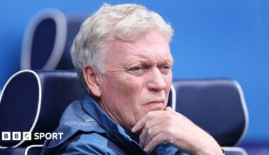 Everton manager David Moyes looks on during the pre-season friendly against Bolton Wanderers