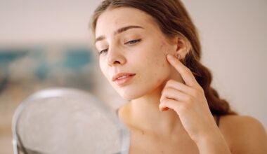 Formaldehyde Contact Allergy Remains a Global Concern