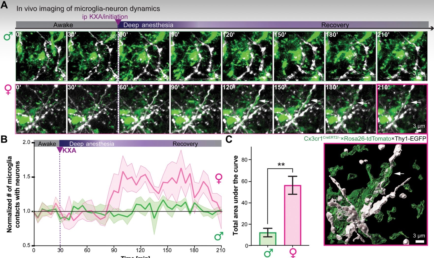 Ketamine Anesthesia Changes Brain Structures, But Only In Females, Mouse Study Suggests 