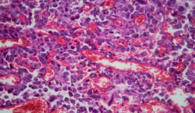Some cancers are being detected too late. Here’s what experts advise.