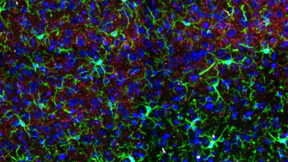 Ketamine Alters Brain Structures – But Only in One Sex, Study in Mice Finds : ScienceAlert