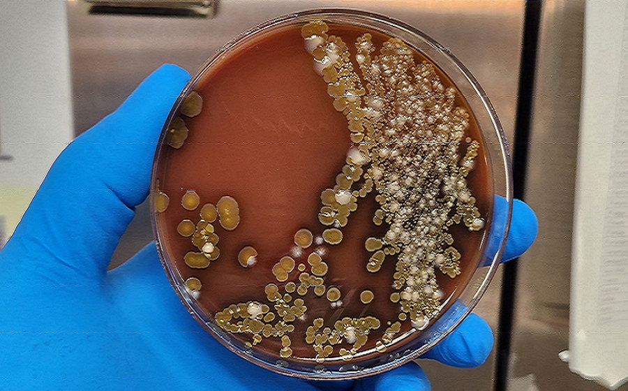 St Vincent Health Ministry monitors Drug-Resistant Bacteria at MCMH