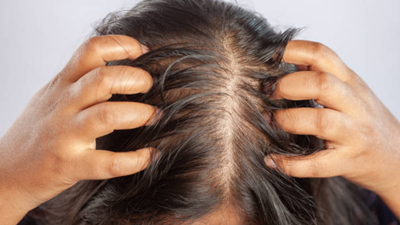 India's fitness boom comes with a hidden cost: Expert reveals what creatine could mean for your hairline