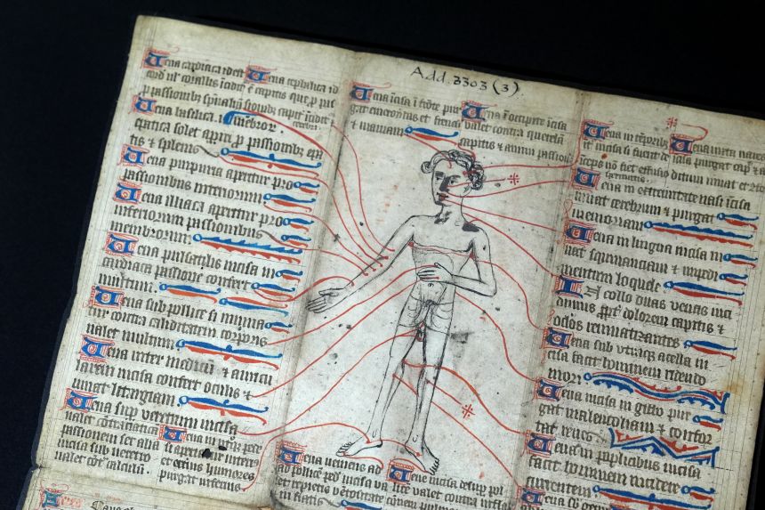 A 14th century manuscript illustration told doctors which parts of the human body to bleed in order to treat specific ailments.