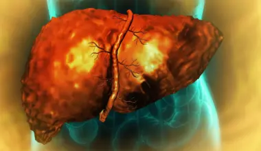 Scientists find why the liver may not heal even after you stop drinking