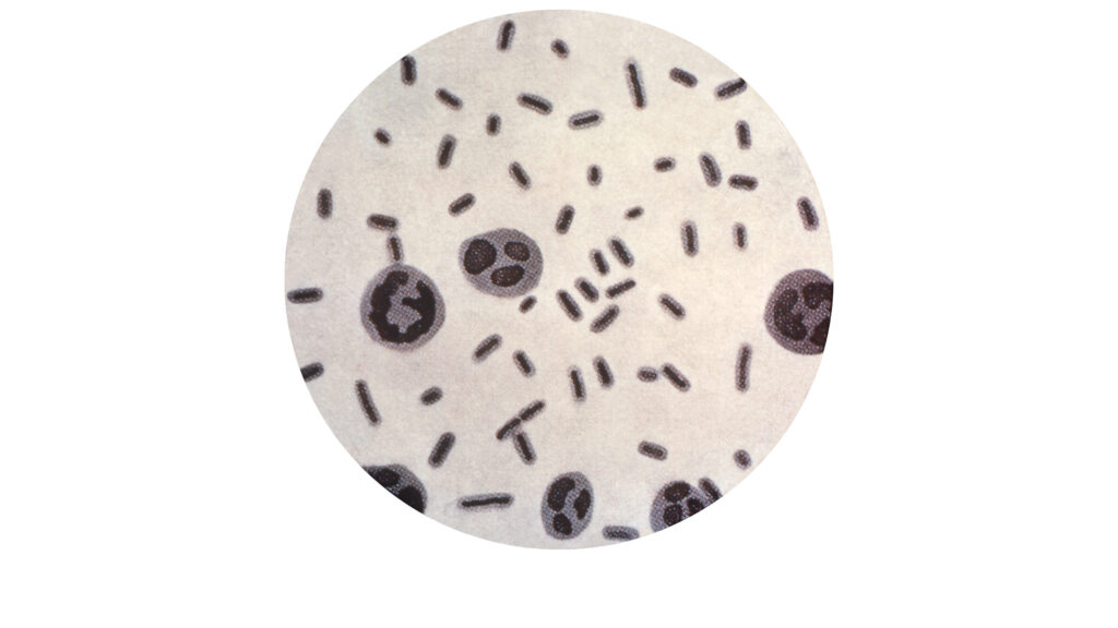 Merck discontinues antiobiotic Recarbrio in U.S., despite superbug fears