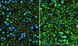 Advanced optical imaging reveals hidden activity in blood immune cells