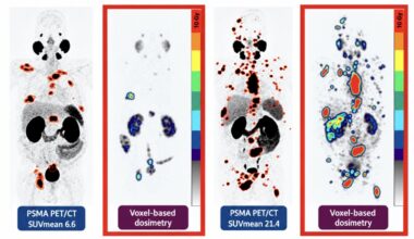ProsTIC26: Appropriate Use of Lutetium PSMA in 2026